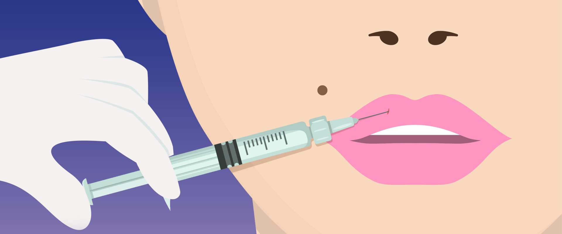 How much is a syringe of lip filler?