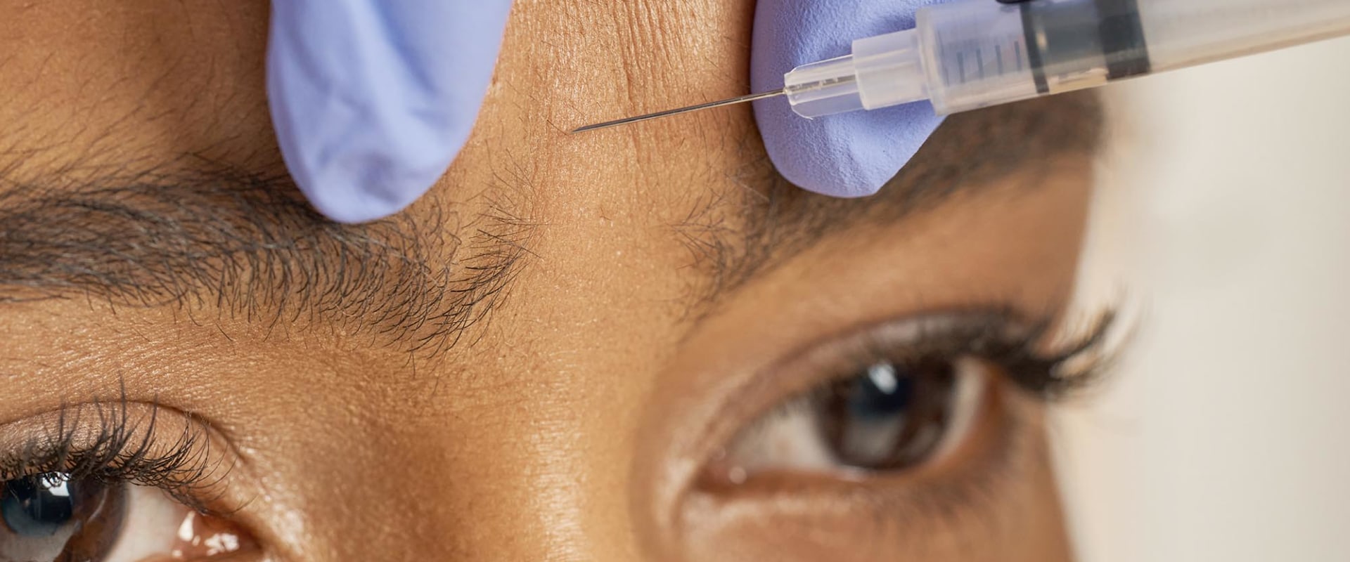 Botox vs Dermal Fillers: Which is Better for You?