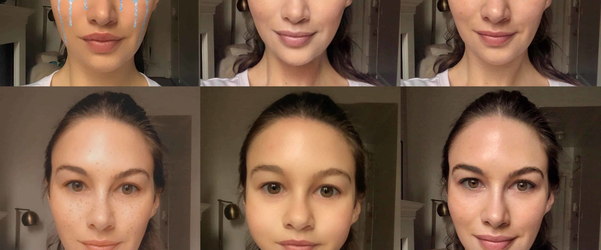 Do Fillers Change the Look of Your Face?