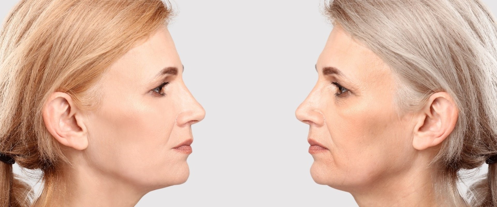 Facial Fillers by Flawless Faces For Younger-Looking You