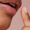 How Long Do Dermal Fillers Last?