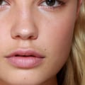 What to Expect After Lip Filler Injections