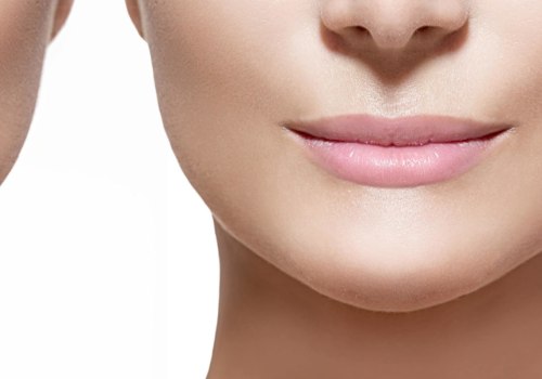 Can You Have Facial Fillers When Pregnant?