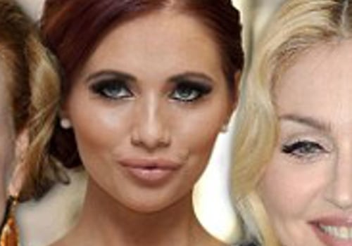 Do Fillers Make You Look Older When They Wear Off?
