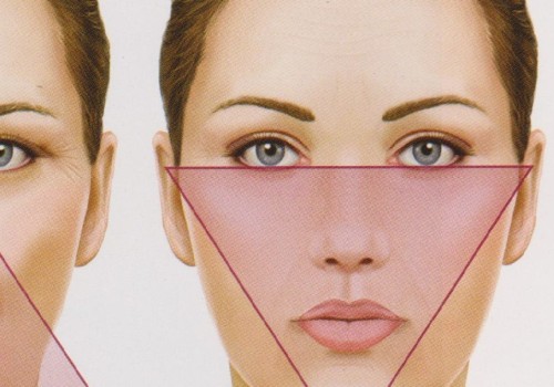 Where Should Cheek Fillers Go? A Comprehensive Guide