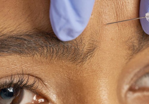 Is it better to get botox or fillers?