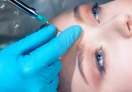 The Fascinating History of Dermal Fillers
